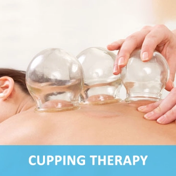 Cupping Therapy