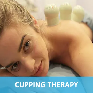 Chiropractic Torrance, CA Cupping Therapy Service Box